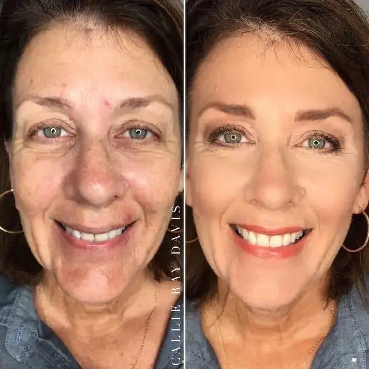 Smooth & Glow Kit